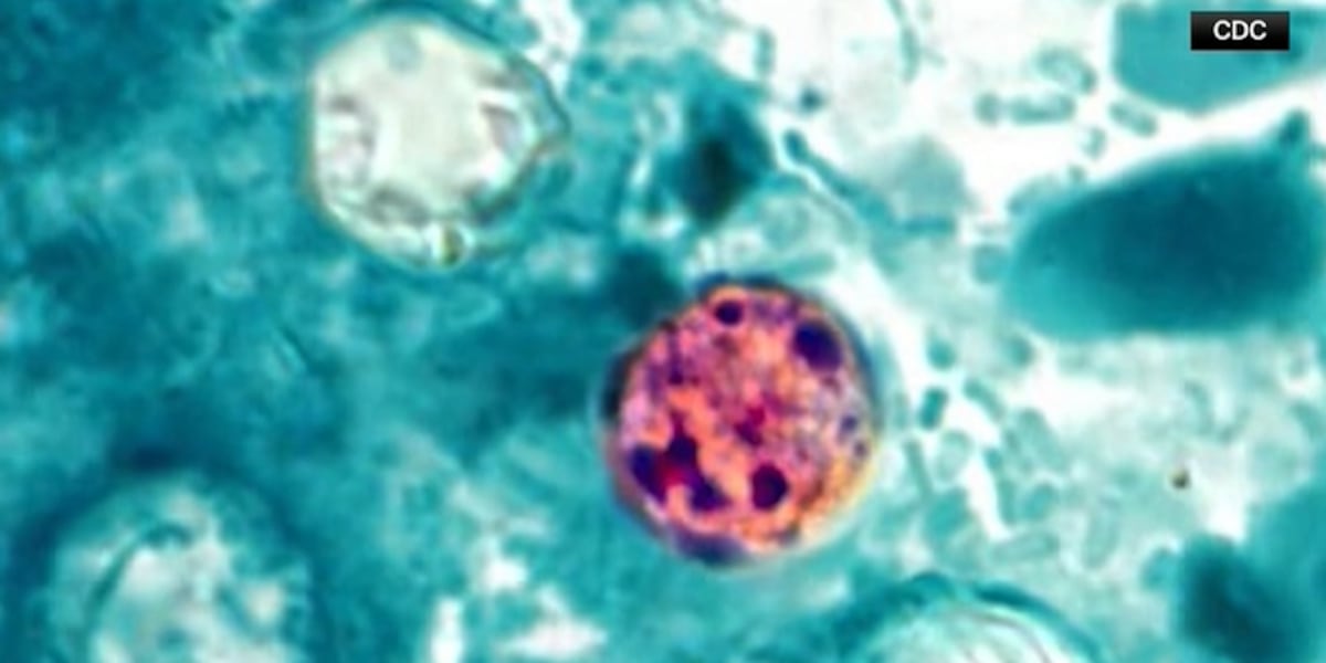 Washoe County reports second case of cyclosporiasis