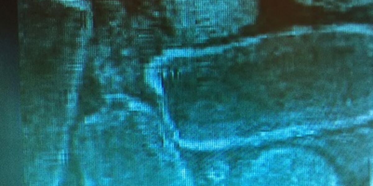 Potential rabies exposure increases as fall approaches