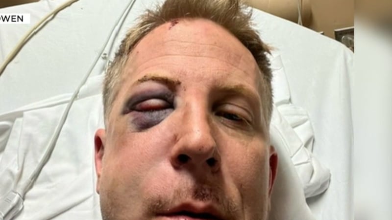 Golden Knights fan searching for man who punched him, sent him to hospital after Dallas game