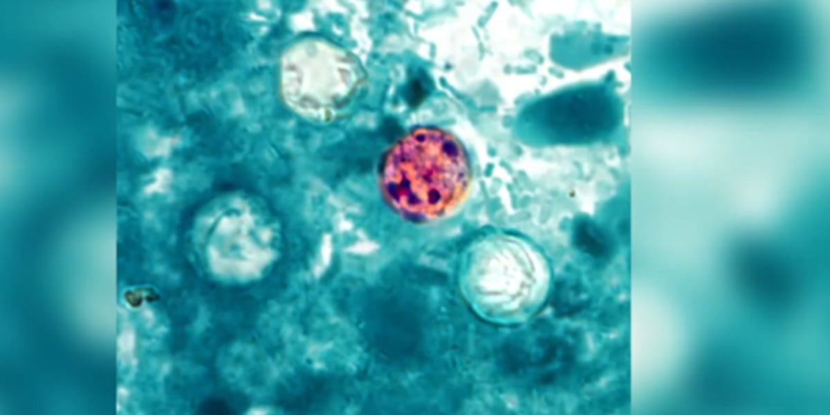Nevada not part of the Cyclosporiasis outbreak